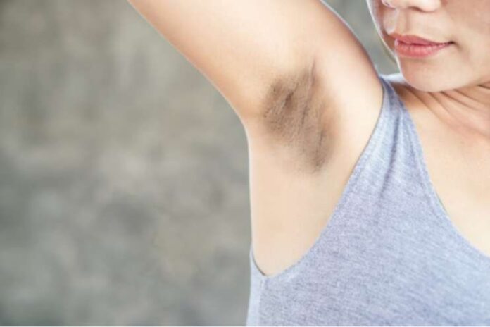 Treat Dark underarms