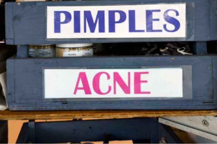 Pimples Acne