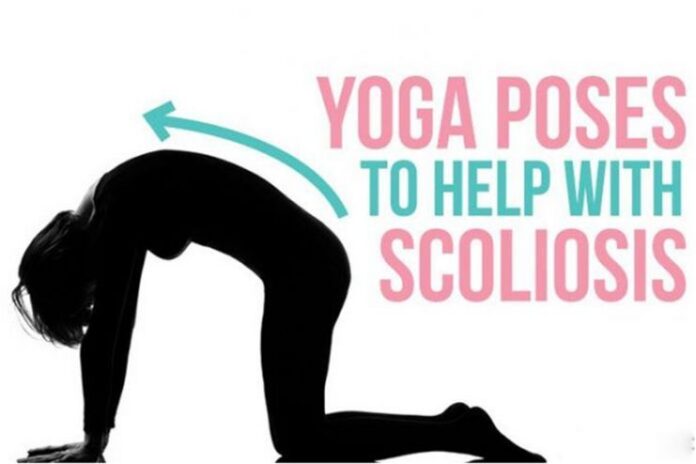 Top 6 Yoga Exercises for Scoliosis