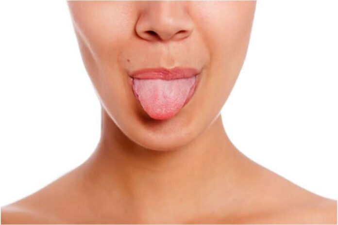 How to Get Rid of Wavy Tongue