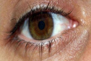 When Are Eye Floaters And Flashes A Medical Emergency?