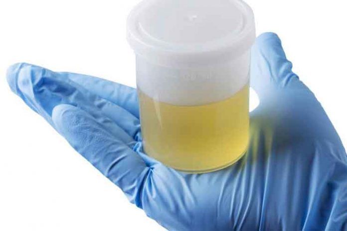 What Does Cloudy Urine Mean Cloudy Urine Causes And Treatment 6857