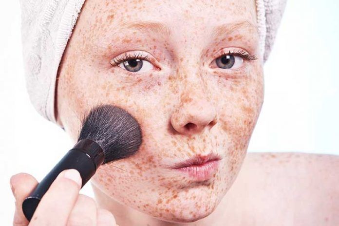 9 Easy And Effective Home Remedies For Freckles Removal At Home 3988