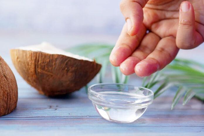 Ways to Heal Burns with Coconut Oil Easily