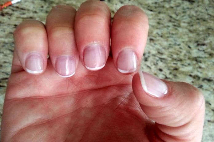 How To Stop Biting the Nails? 10 Ways To Get Rid Of This Bad Habit