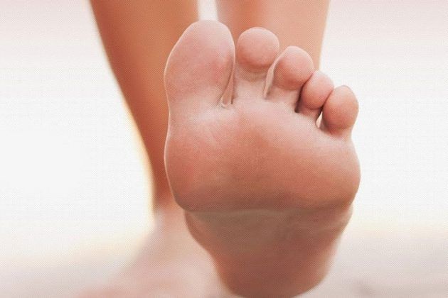 12-ways-to-reduce-edema-naturally-get-rid-of-the-swelling