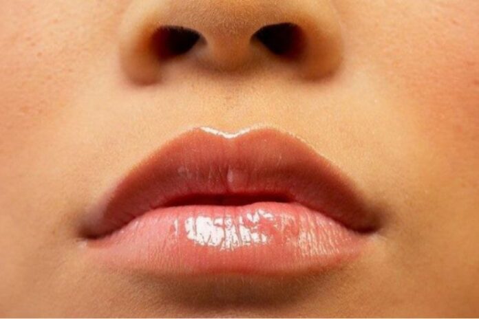 Lighten Dark Upper Lip