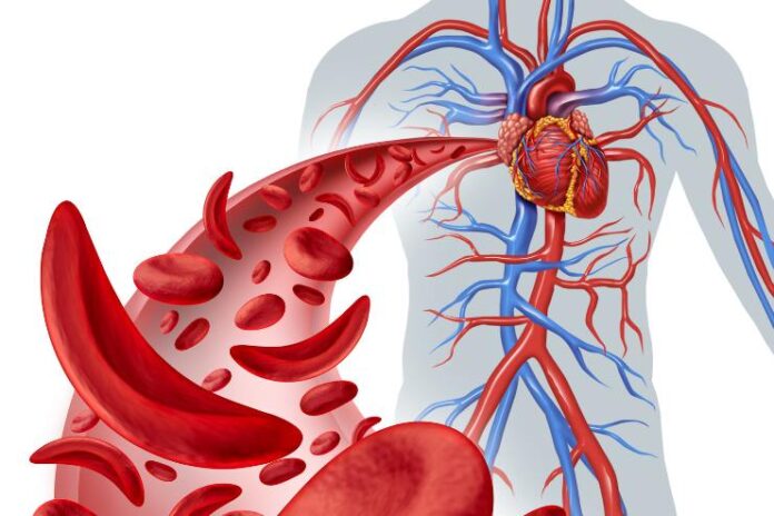 Lifestyle Changes to Prevent Blood Clots