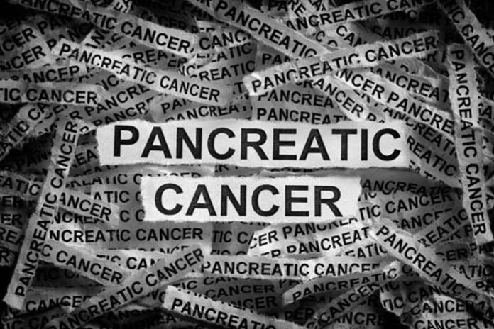 Early-Symptoms-of-Pancreatic-Cancer