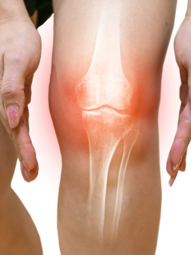 Tips to Prevent Osteoarthritis and Protect  Your Joints