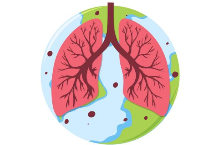 Managing Idiopathic Pulmonary Fibrosis IPF