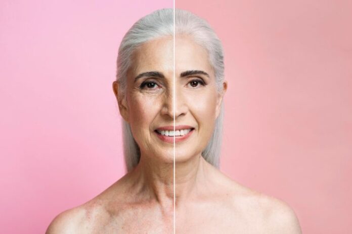 Cryotherapy for Anti-Aging