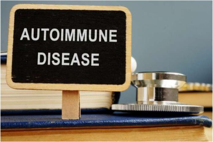 Managing Autoimmune Diseases