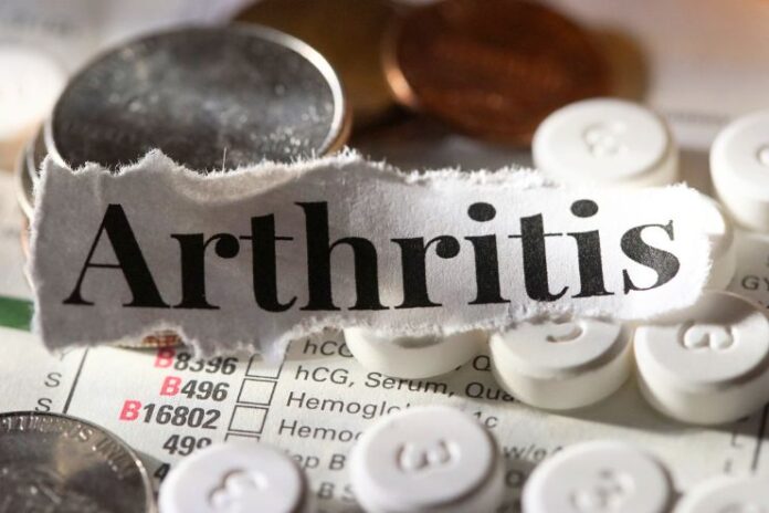 Ways to Support a Loved One with Arthritis